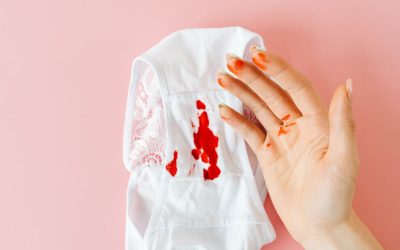 Ta bort blodfläckar – så gör du
